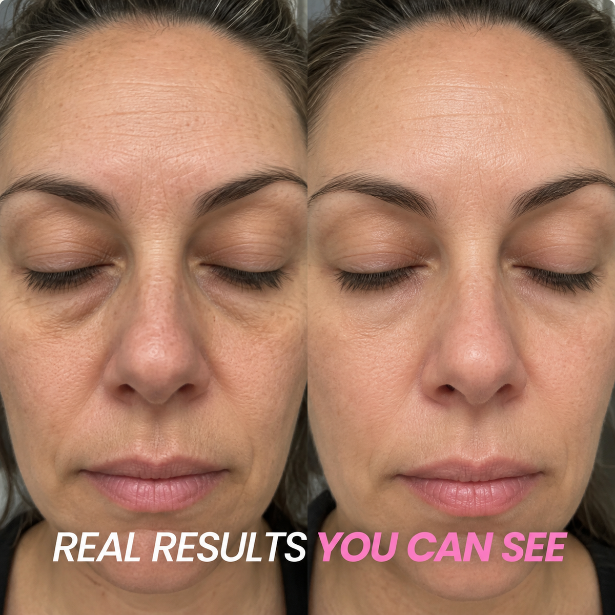 LUM+ Collagen Plump & Repair Volufiline Balm